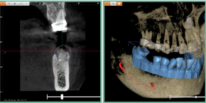 ng28南宫与精瓷义齿共创齿科3D打印医疗新未来