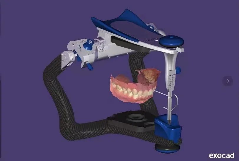 ng28南宫与精瓷义齿共创齿科3D打印医疗新未来