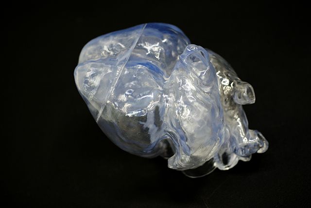 联泰答疑室 | 3D打印,我劝你在医疗行业别这么“嚣张”