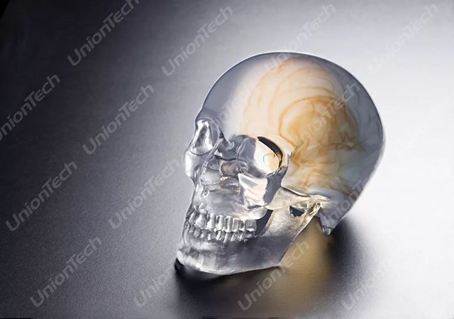 联泰答疑室 | 3D打印,我劝你在医疗行业别这么“嚣张”