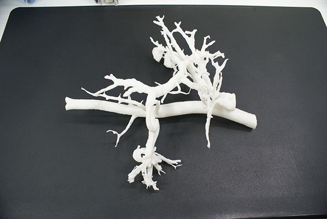 联泰答疑室 | 3D打印,我劝你在医疗行业别这么“嚣张”