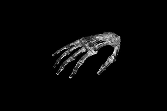 3联泰答疑室 | 3D打印,我劝你在医疗行业别这么“嚣张”