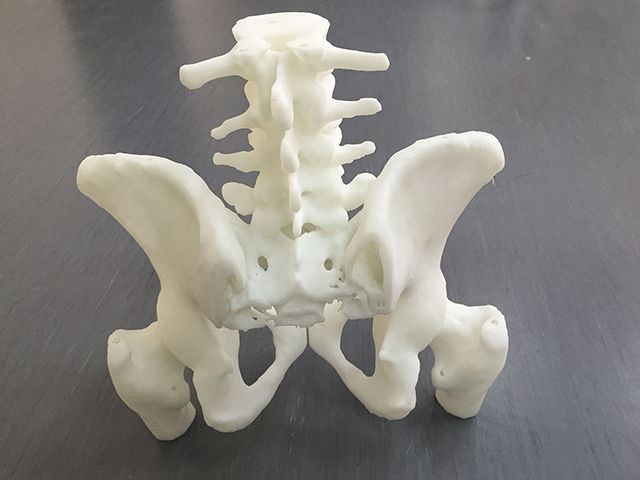 联泰答疑室 | 3D打印,我劝你在医疗行业别这么“嚣张”