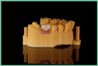 “以科技破局，以数字化赋能”——ng28南宫与精瓷义齿共创齿科3D打印医疗新未来06