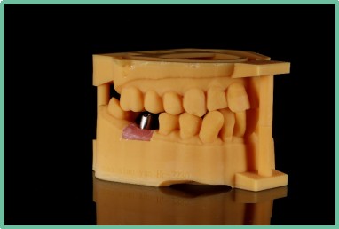 “以科技破局，以数字化赋能”——ng28南宫与精瓷义齿共创齿科3D打印医疗新未来04