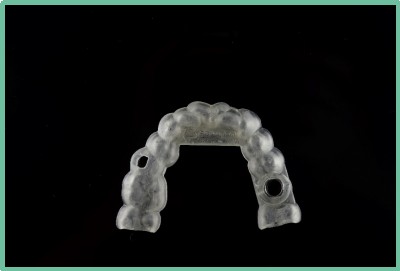 “以科技破局，以数字化赋能”——ng28南宫与精瓷义齿共创齿科3D打印医疗新未来01