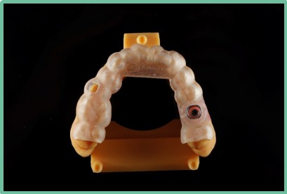 “以科技破局，以数字化赋能”——ng28南宫与精瓷义齿共创齿科3D打印医疗新未来02