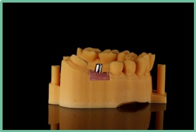 “以科技破局，以数字化赋能”——ng28南宫与精瓷义齿共创齿科3D打印医疗新未来03