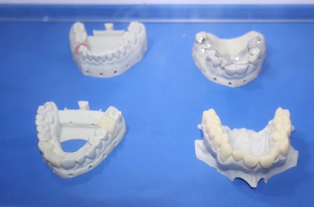 个性化诊疗需求