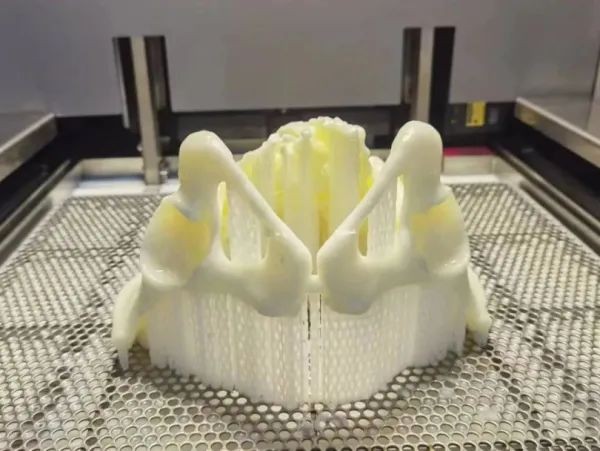 医疗3D打印技术