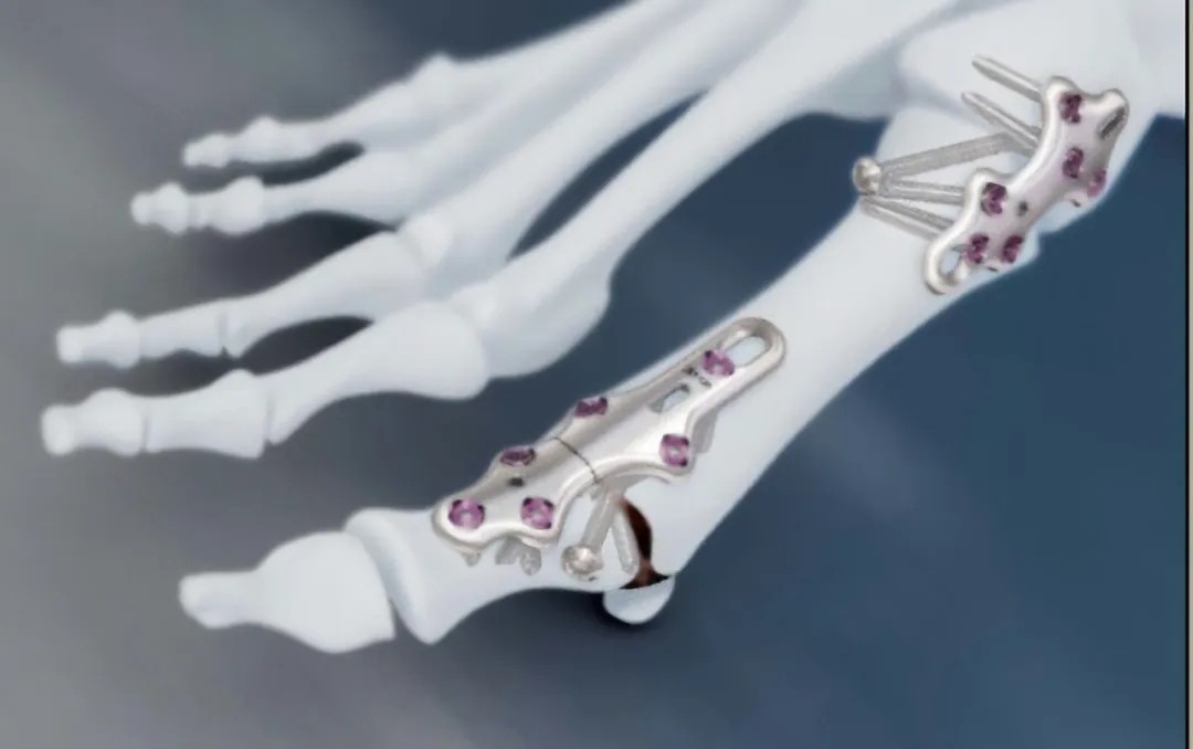 DLP工业3d打印机 